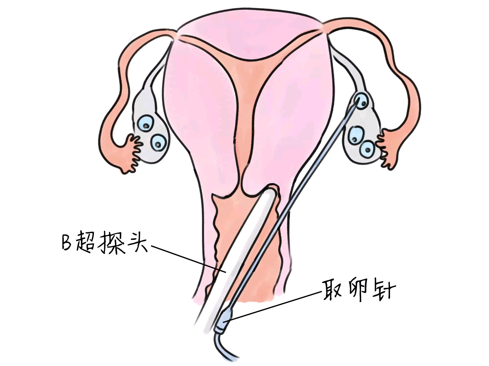 吸引客流