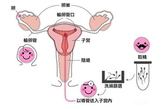 呕吐早孕反应