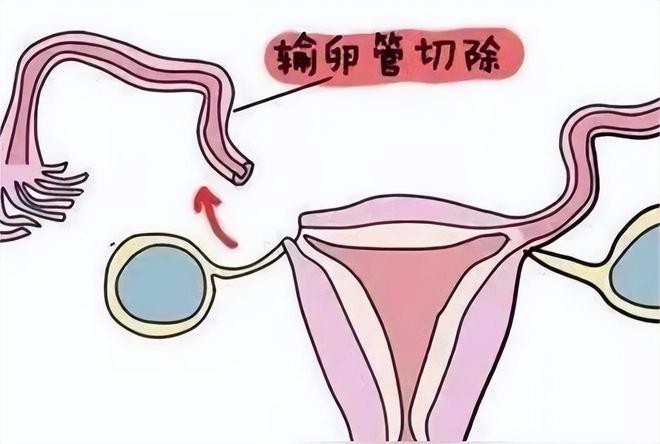喝药小产