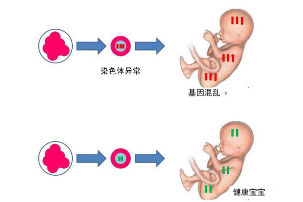 四个月婴儿