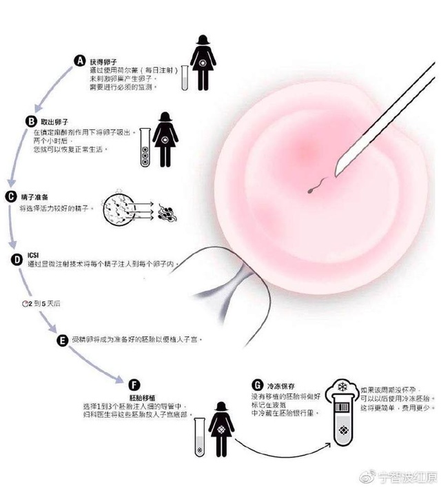 胎位不正