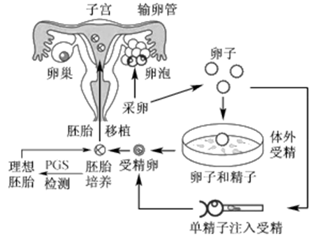 早孕反应