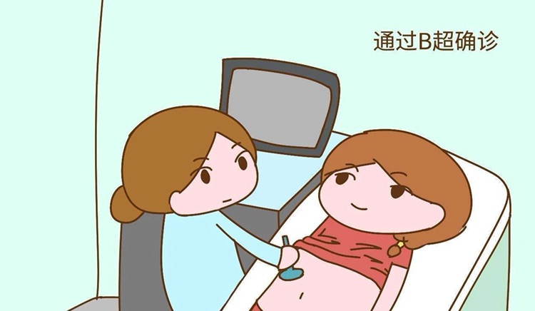 孕妇