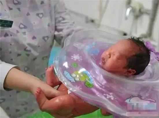 人流手术