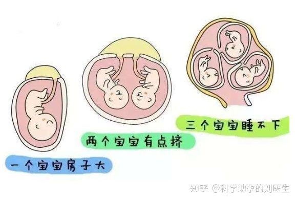 四个月做流产