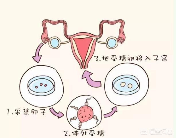 胎位不正