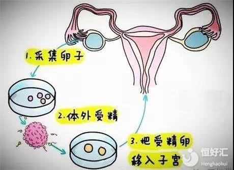 饮料
