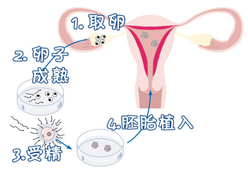 激素六项