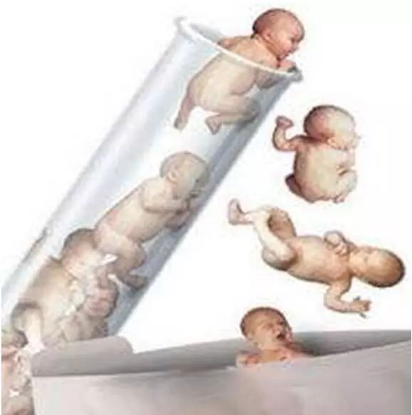 女性取卵手术