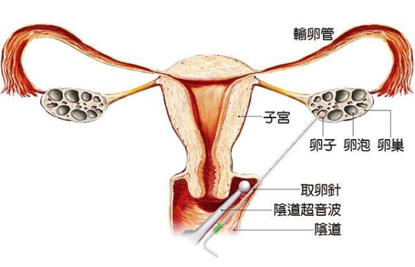 怀孕