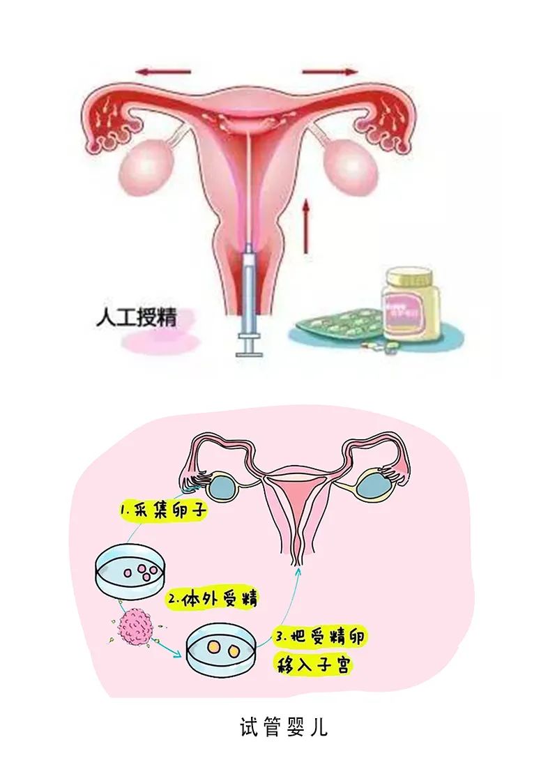停经