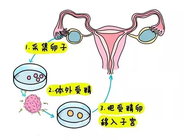 不排卵